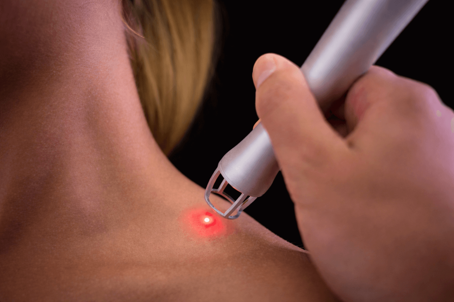 Rimozione Neoformazioni Cutanee